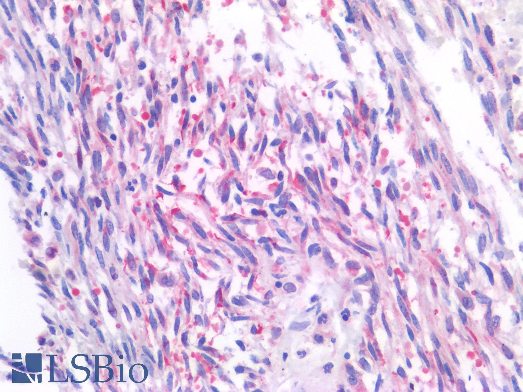 PathPlus™ Polyclonal Rabbit anti-Human GNAQ Antibody (IHC)