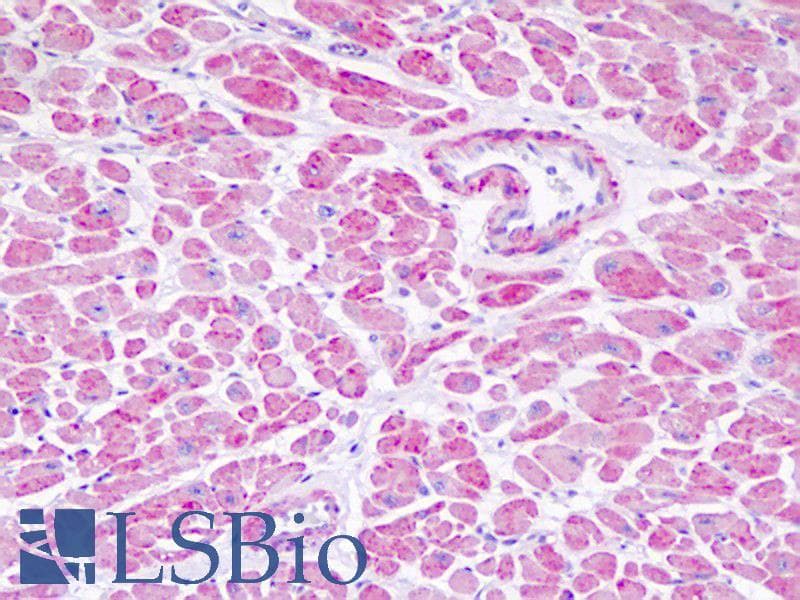 IHC-plus™ Polyclonal Rabbit anti-Human NDUFV1 Antibody (aa21-50, IHC, WB)