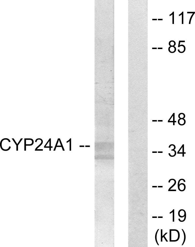 CYP24 / CYP24A1 Antibody