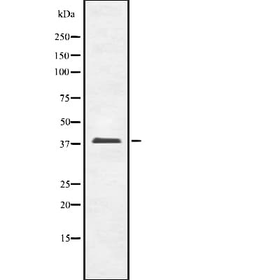 OPCML / OBCAM Antibody