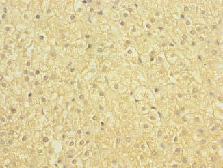 Polyclonal Rabbit anti-Human SLCO2B1 Antibody (IHC)