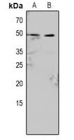 CASP9 / Caspase 9 Antibody