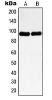 NBN / Nibrin Antibody (Internal)