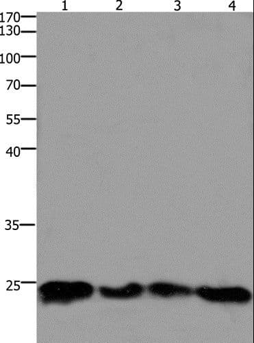 Polyclonal Rabbit anti-Human HMGB3 Antibody (IHC, WB)