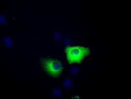 ERIC-1 / TACC3 Antibody (clone OTI7B11)
