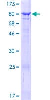 Human ACSF2 Protein (Recombinant GST)