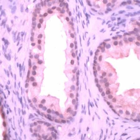 PTEN Antibody