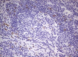 PRX-1 / PRRX1 Antibody (clone OTI1C4, Carrier-free)