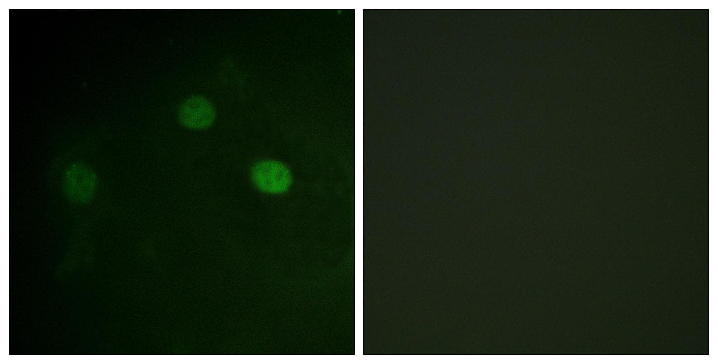 CDK1 / CDC2 Antibody (phospho-Thr14)