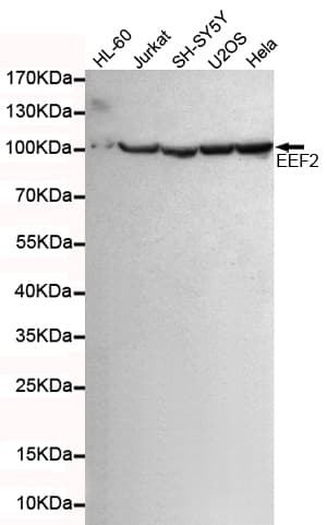EEF2 / Elongation Factor 2 Antibody