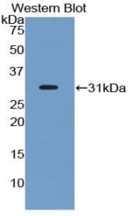 EPHA1 / EPH Receptor A1 Antibody (aa599-842)