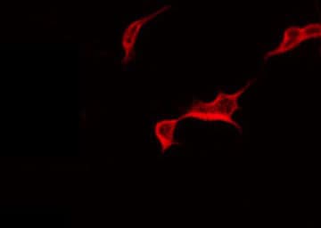 CCR5 Antibody