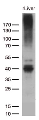 Monoclonal Mouse anti-Human ABCC2 / MRP2 Antibody (clone OTI5C3, aa1256-1545, IHC, WB)