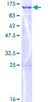 Human MLPH / Melanophilin Protein (Recombinant GST)