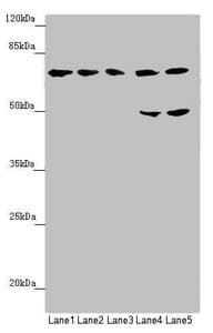 Complement C8b Antibody (aa55-350)