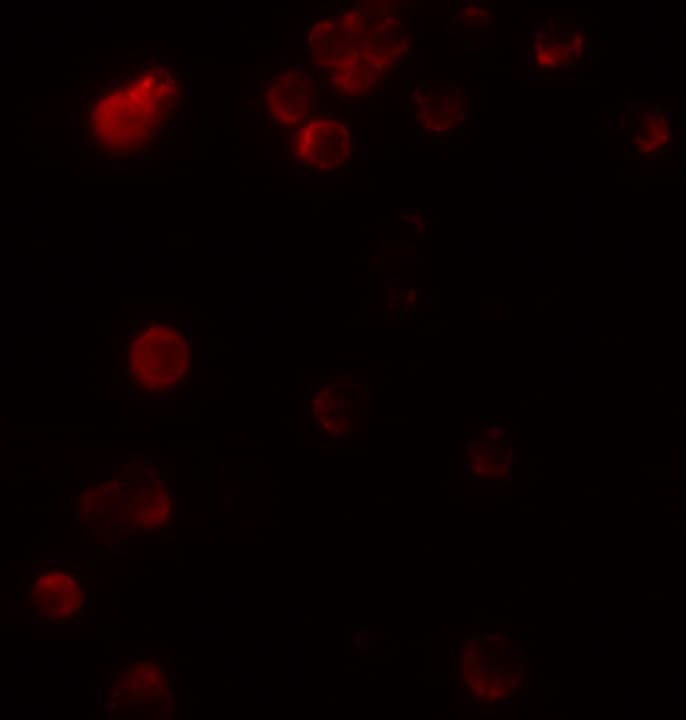Polyclonal Rabbit anti-Human KIR2DS2 / CD158j Antibody (IF, WB)