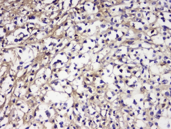 Polyclonal Rabbit anti-Human IGLL1 / CD179b Antibody (IHC, WB)