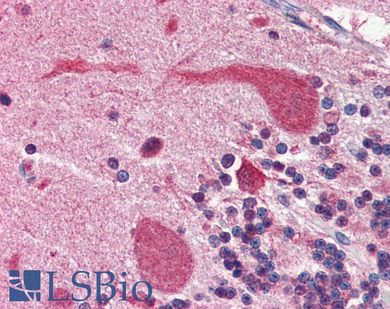 IHC-plus™ HSP90 / Heat Shock Protein 90 Antibody (aa1-732, clone 4F10)