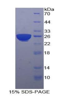 Human PSG1 / CD66f Protein (Recombinant His-T7)
