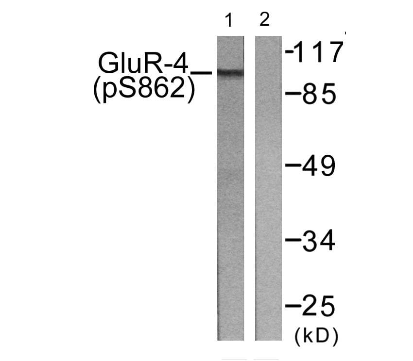 GRIA4 / GLUR4 Antibody (phospho-Ser862)