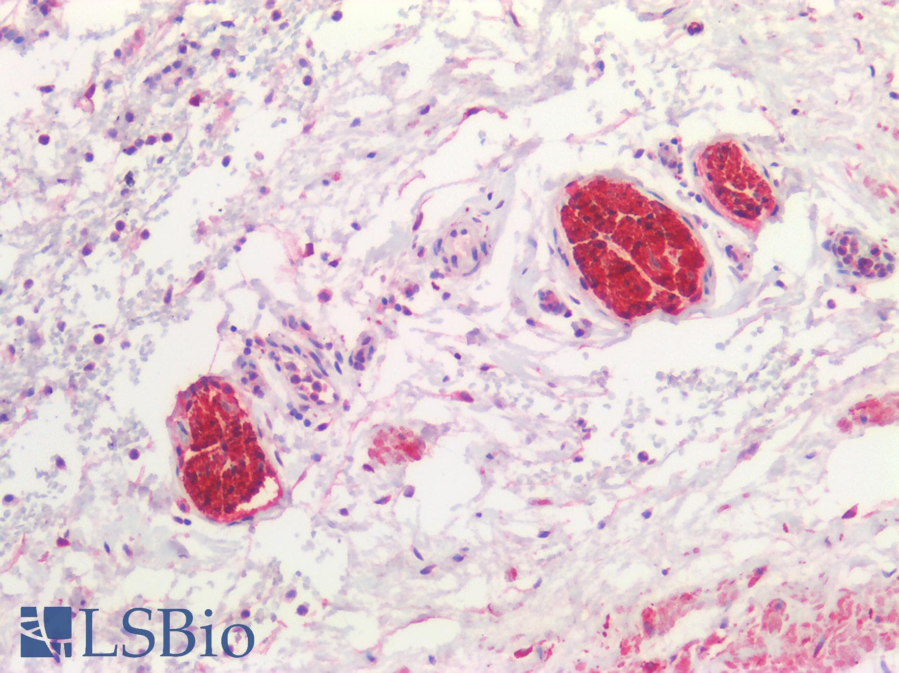 PathPlus™ UCHL1 / PGP9.5 Antibody