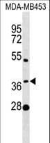 MTHFSD Antibody (aa43-69)