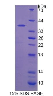 Rat RICK / RIP2 Protein (Recombinant)