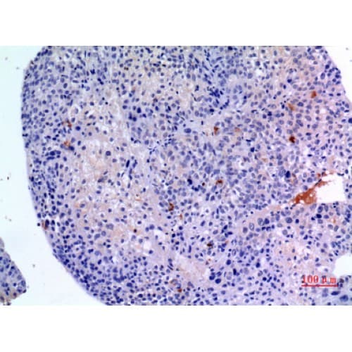 Polyclonal Rabbit anti-Human BMP3 Antibody (411-460 aa, C-terminal, IHC, WB)