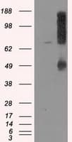 LOX / Lysyl Oxidase Antibody (clone OTI9G6)