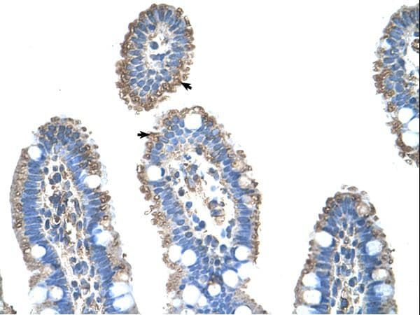 SLC22A1 Antibody (aa100-149, Biotin)