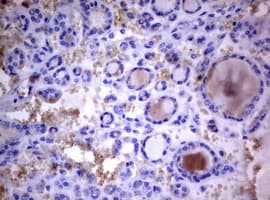 PIK3C2A Antibody (aa230-560, clone OTI3H2)