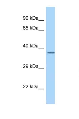 LRRC39 Antibody (C-Terminus)