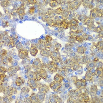Polyclonal Rabbit anti-Human FAH Antibody (IHC, IF, WB)