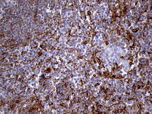 Monoclonal Mouse anti-Human IFITM2 Antibody (clone OTI3B1, IHC, WB)