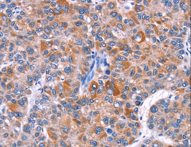 Polyclonal Rabbit anti-Human ELP2 / STATIP1 Antibody (IHC)