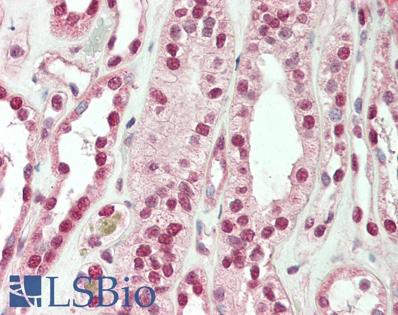PathPlus™ SMARCA4 / BRG1 Antibody (aa75-125)
