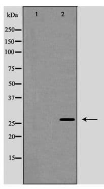 Polyclonal Rabbit anti-Human CAV2 / Caveolin 2 Antibody (phospho-Tyr27, WB)