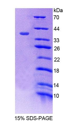 Mouse SNTB1 / A1B Protein (Recombinant His-T7)