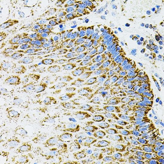 EPO / Erythropoietin Antibody