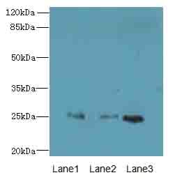 RAB3B Antibody
