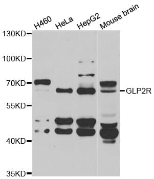 GLP2R Antibody