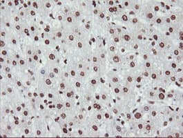 NONO / P54NRB Antibody (clone OTI3F8)