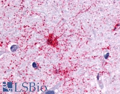 PathPlus™ P2Y13 / P2RY13 Antibody (Cytoplasmic Domain)