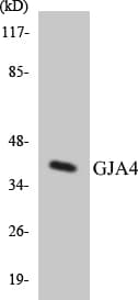 GJA4 / CX37 / Connexin 37 Antibody (aa67-116)
