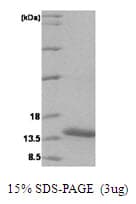 Human VAMP1 / VAMP-1 Protein (Recombinant His)