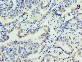 FOSL2 / FRA-2 Antibody (aa187-326)