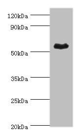 ALDH1A1 / ALDH1 Antibody (aa202-501)