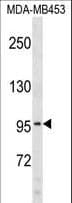 COL6A2 / Collagen VI Alpha 2 Antibody (aa719-747)