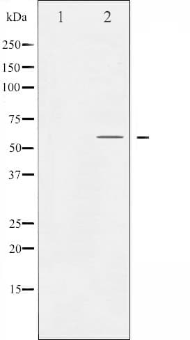 SMAD2 Antibody