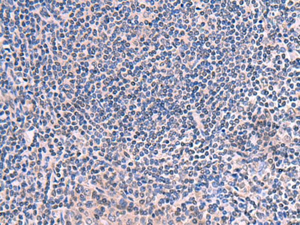 SCCPDH Antibody